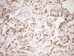 LPIN1 Antibody in Immunohistochemistry (Paraffin) (IHC (P))