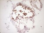 LPIN1 Antibody in Immunohistochemistry (Paraffin) (IHC (P))