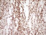 LPIN1 Antibody in Immunohistochemistry (Paraffin) (IHC (P))