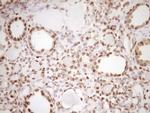 LPIN1 Antibody in Immunohistochemistry (Paraffin) (IHC (P))