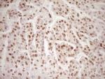 LPIN1 Antibody in Immunohistochemistry (Paraffin) (IHC (P))