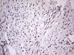 LPIN1 Antibody in Immunohistochemistry (Paraffin) (IHC (P))