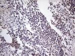 LPIN1 Antibody in Immunohistochemistry (Paraffin) (IHC (P))