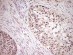 LPIN1 Antibody in Immunohistochemistry (Paraffin) (IHC (P))