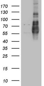 LPIN1 Antibody in Western Blot (WB)