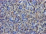 LPL Antibody in Immunohistochemistry (Paraffin) (IHC (P))