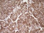 LRRC6 Antibody in Immunohistochemistry (Paraffin) (IHC (P))