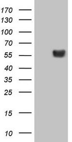 LRRC6 Antibody in Western Blot (WB)