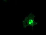 LSM1 Antibody in Immunocytochemistry (ICC/IF)