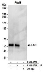 LSR Antibody in Western Blot (WB)