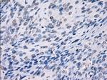 LTA4H Antibody in Immunohistochemistry (Paraffin) (IHC (P))