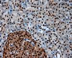 LTA4H Antibody in Immunohistochemistry (Paraffin) (IHC (P))