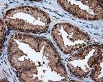 LTA4H Antibody in Immunohistochemistry (Paraffin) (IHC (P))