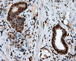 LTA4H Antibody in Immunohistochemistry (Paraffin) (IHC (P))