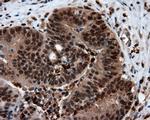 LTA4H Antibody in Immunohistochemistry (Paraffin) (IHC (P))