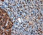 LTA4H Antibody in Immunohistochemistry (Paraffin) (IHC (P))