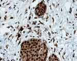 LTA4H Antibody in Immunohistochemistry (Paraffin) (IHC (P))