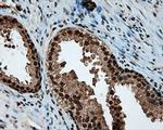 LTA4H Antibody in Immunohistochemistry (Paraffin) (IHC (P))