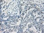 LTA4H Antibody in Immunohistochemistry (Paraffin) (IHC (P))