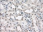 LTA4H Antibody in Immunohistochemistry (Paraffin) (IHC (P))