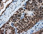 LTA4H Antibody in Immunohistochemistry (Paraffin) (IHC (P))