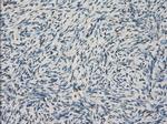 LTA4H Antibody in Immunohistochemistry (Paraffin) (IHC (P))