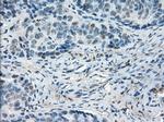 LTA4H Antibody in Immunohistochemistry (Paraffin) (IHC (P))