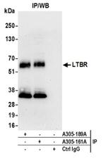 LTBR/Lymphotoxin-beta Receptor Antibody in Western Blot (WB)