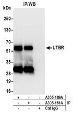 LTBR/Lymphotoxin-beta Receptor Antibody in Western Blot (WB)