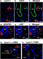 LYVE1 Antibody in Immunohistochemistry (IHC)