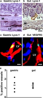 LYVE1 Antibody in Immunohistochemistry (IHC)