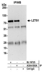 LZTS1 Antibody in Western Blot (WB)