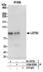 LZTS2 Antibody in Immunoprecipitation (IP)