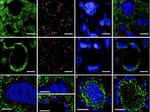 CD207 (Langerin) Antibody in Immunocytochemistry (ICC/IF)