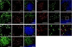 CD207 (Langerin) Antibody in Immunocytochemistry (ICC/IF)