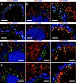 CD207 (Langerin) Antibody in Immunocytochemistry (ICC/IF)