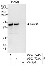 Lipin2 Antibody in Immunoprecipitation (IP)