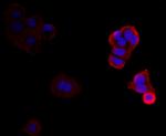 Cytokeratin 17 Antibody in Immunocytochemistry (ICC/IF)