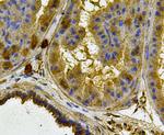 Cytokeratin 17 Antibody in Immunohistochemistry (Paraffin) (IHC (P))