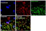 mCherry Antibody in Immunocytochemistry (ICC/IF)