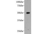 LRP-1 Antibody in Western Blot (WB)