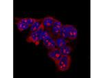 LIN28A Antibody in Immunocytochemistry (ICC/IF)