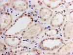 LIN28A Antibody in Immunohistochemistry (Paraffin) (IHC (P))