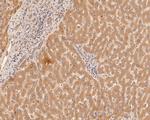 Alpha-2-macroglobulin Antibody in Immunohistochemistry (Paraffin) (IHC (P))