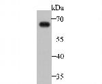 IgA Antibody in Western Blot (WB)