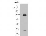 IgA Antibody in Western Blot (WB)