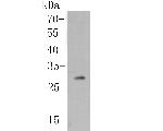 Human IgM Antibody in Western Blot (WB)