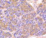 HSPA5 Antibody in Immunohistochemistry (Paraffin) (IHC (P))