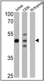 CD2 Antibody in Western Blot (WB)