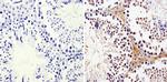 LIN28A Antibody in Immunohistochemistry (Paraffin) (IHC (P))